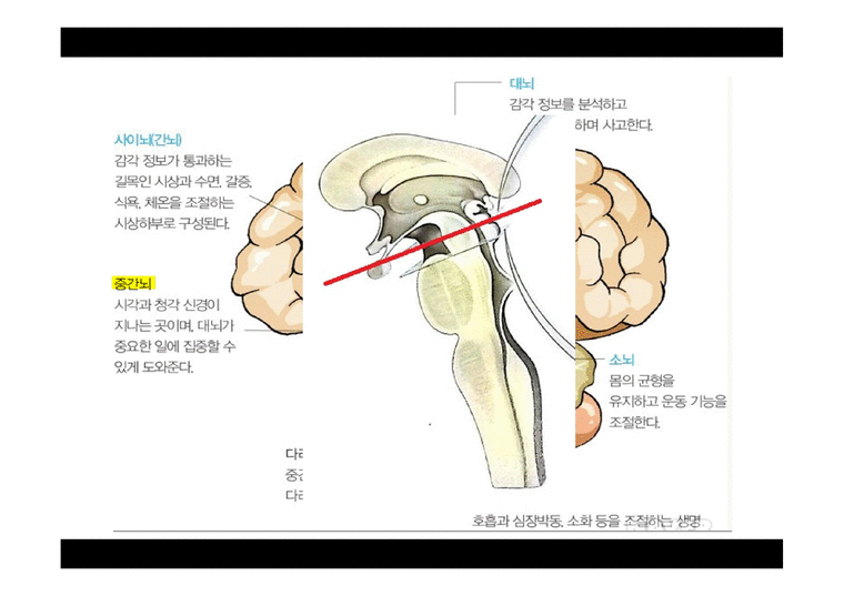파킨슨병 (Parkinson`s disease) 병태생리 및 진단 - 의약학