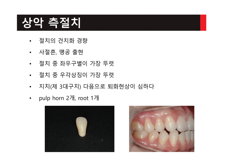 치아 형태학 최종(세미나)-3페이지