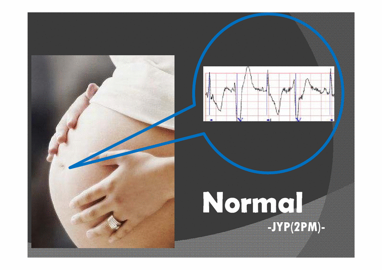 PBL  임신 정기검진시 태아의 심장박동 불규칙 진단 사례(영문)-2페이지