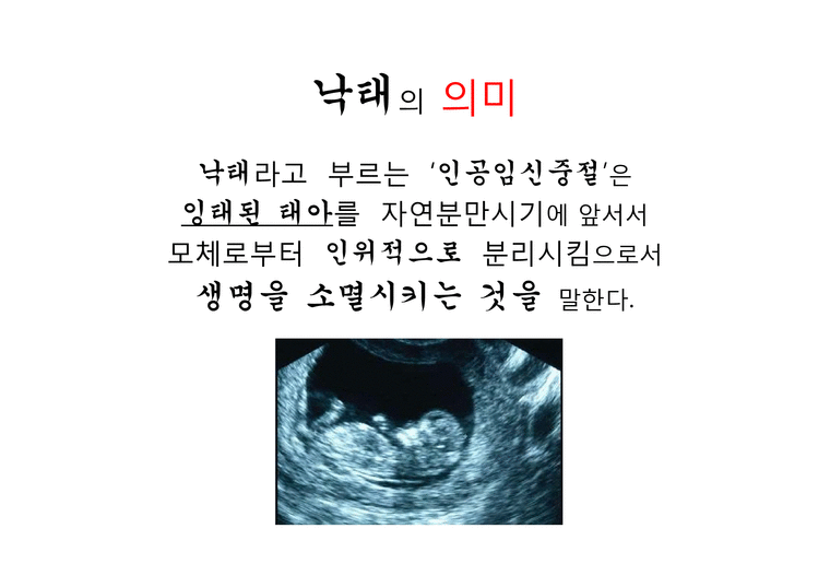 낙태 반대입장 레포트-4페이지