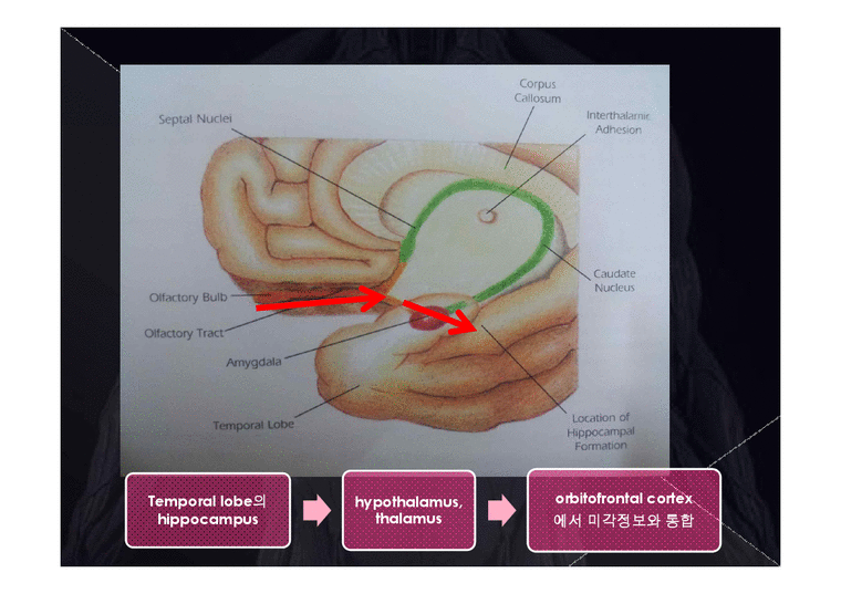 의학  뇌신경 The cranial nerves 에 관해서-4페이지