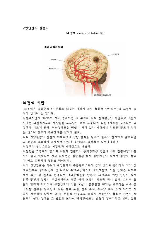 성인간호학 실습 - 뇌경색 cerebral infarction 조사-1페이지