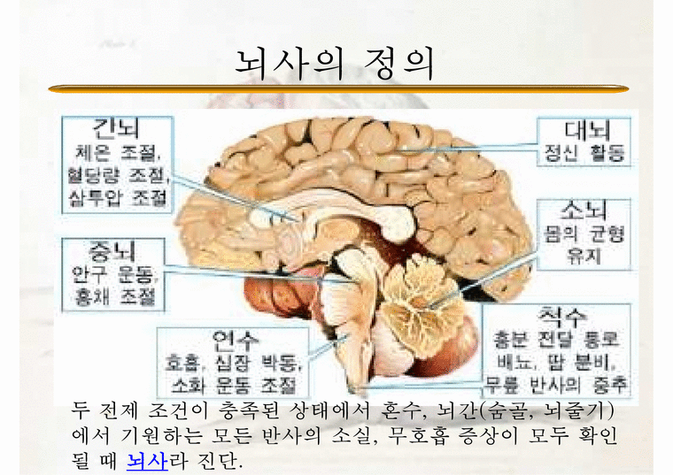 뇌사-살아있는 신체의 죽은 뇌 뇌사의 정의 뇌사의 개념 죽음의 판단 뇌사 찬성 뇌사 반대 뇌사 해결방안 - 사회과학