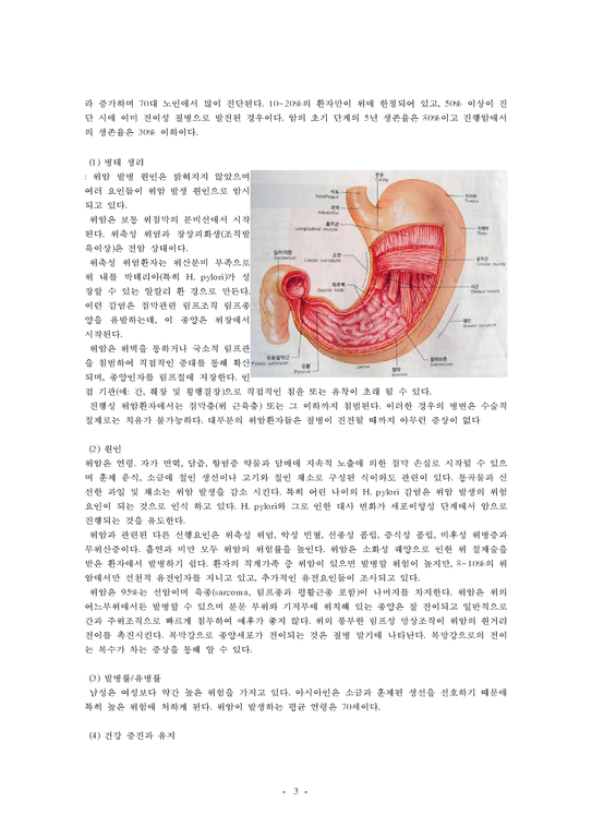 간호 case study 성인(병동) 위의 악성 신생물(위암)(Malignant neoplasm of body of stomach)-3페이지