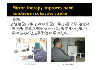 Mirror therapy improves hand function in subacute stroke A randomized controlled trial-9페이지