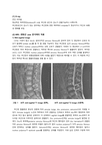 PBL  추간판 탈출증의 MRI 와 CT 상의 소견 차이-4페이지