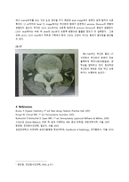 PBL  추간판 탈출증의 MRI 와 CT 상의 소견 차이-6페이지