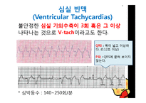 건강과 간호  동성리듬  EKG 리듬 PBL-16페이지