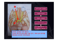 의학  뇌신경 The cranial nerves 에 관해서-8페이지