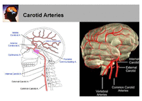 의학  뇌혈관 해부학과 뇌혈과 손상시 임상양상-7페이지