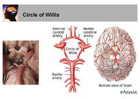 의학  뇌혈관 해부학과 뇌혈과 손상시 임상양상-9페이지