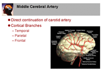 의학  뇌혈관 해부학과 뇌혈과 손상시 임상양상-14페이지