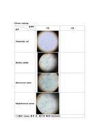 미생물학 실험 - Simple staining(단순염색)  Gram staining(그람염색) 실험-7페이지