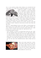 간암(liver cancer)간호-4페이지