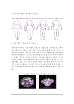 비만의 종류(유형) - 상체비만과 하체비만  피하지방형 비만과 내장지방형 비만  세포증식형 비만과 세포비대형 비만-3페이지